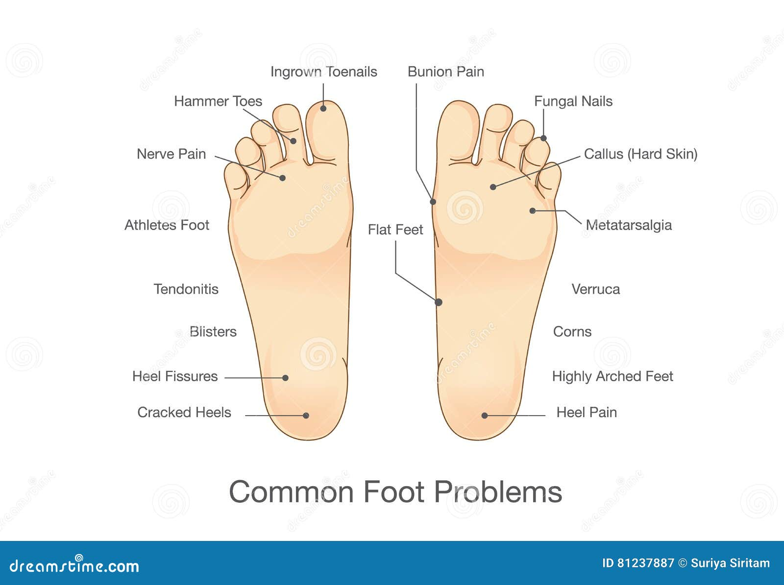 Podiatric Conditions